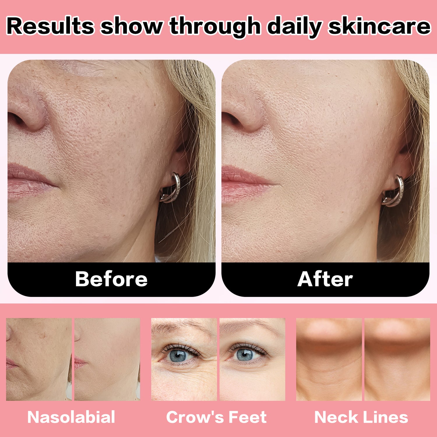 3-in-1 Facial Depuffing Wand | Sculpt, Lift & Depuff